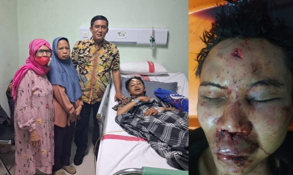 Camat Rancakalong Jenguk Warga Cibunar yang Diduga Menjadi Korban Penganiayaan 